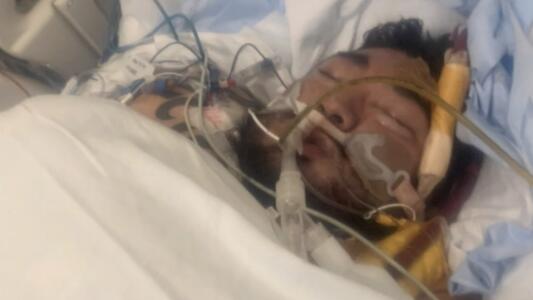 Estuvo a punto de morir tres veces: joven hispano logra sobrevivir luego de seis semanas en coma por el covid-19